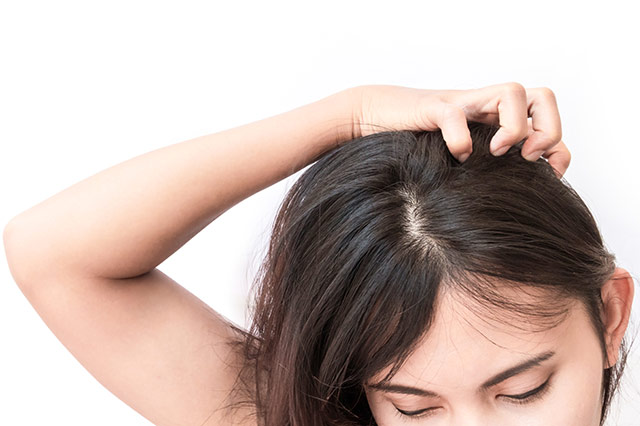 頭皮の状態が乱れるのは、抜け毛が増えてしまう原因のひとつです。